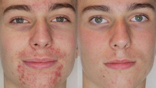 Matteo, 16